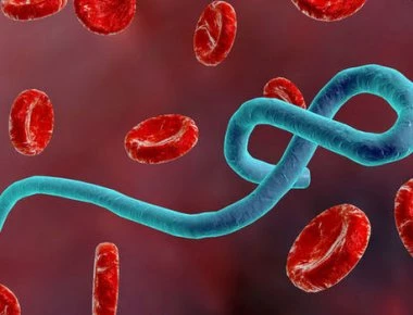 Συναγερμός στην Ευρώπη από κρούσμα Έμπολα